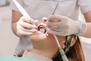 Professional Dental Cleaning Before Cosmetic Dentistry: Why It Matters